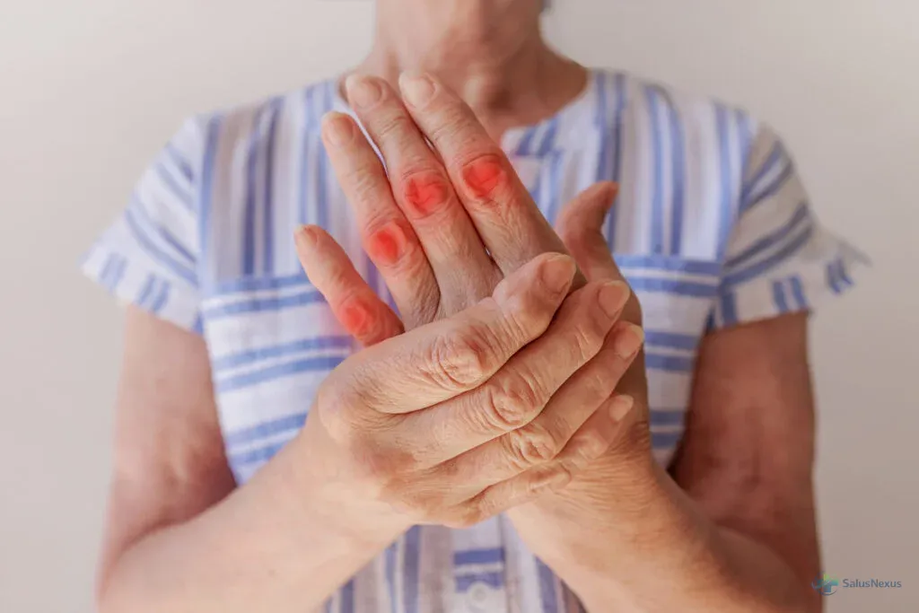 Artrite reumatoide: a dor nas juntas que não é artrose — sintomas, diagnóstico e por que tratar cedo muda tudo
